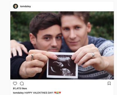 汤姆·戴利的写真